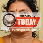 അമീബിക് മസ്തിഷ്‌ക ജ്വരം ബാധിച്ച് ചികിത്സയിലായിരുന്ന മലപ്പുറം സ്വദേശിനി മരിച്ചു ; ഒരു മാസത്തിനിടെ മരിച്ചത് അഞ്ച് പേര്‍