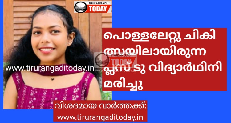 പൊള്ളലേറ്റു ചികിത്സയിലായിരുന്ന പ്ലസ് ടു വിദ്യാർഥിനി മരിച്ചു